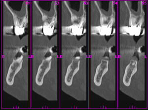 Scan2 yo6rvy - Eugenol