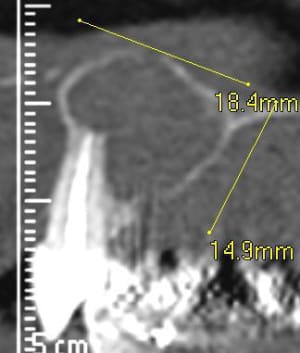 Scan profill en 11 pjuseg - Eugenol