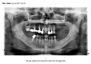 Sli dje jiwkjg - Eugenol