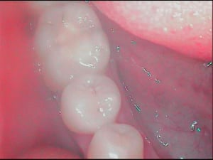 Soupcon gvgm4k - Eugenol