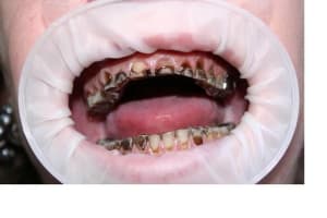 Souriredenfer2 va3bta - Eugenol