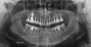 Sr1zv7dzgm4qxa7of9q8q6ics7d1 - Eugenol