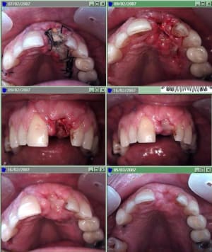 Suite lambeau tlmdh1 - Eugenol