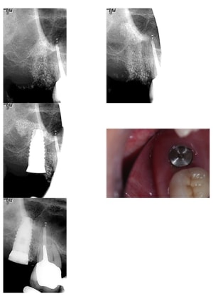 Summers  q1dkut - Eugenol