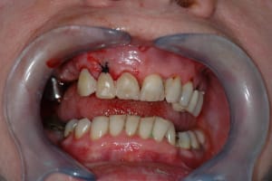 T3 jc2woe - Eugenol
