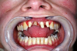 Tailles vhndiy - Eugenol