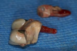 Tartre2 l8f9ud - Eugenol