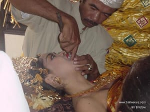 Teeth6 g64zpc - Eugenol