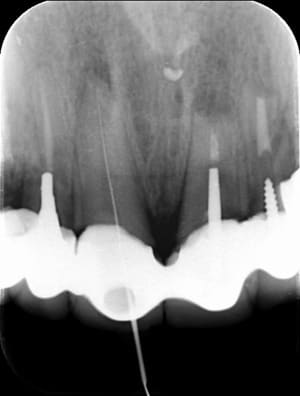 Tg0cc3daxpbnejwgpgqy - Eugenol
