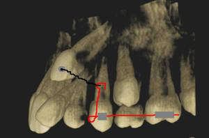 Traction canine ge5ayk - Eugenol