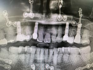 Txntf0lfq4a03a9r08a5ogwno7ia - Eugenol