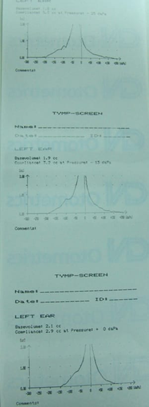 Tymp3 fztkj6 - Eugenol