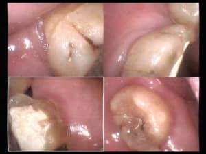 Un cas difficile paro à 90 jours 3 vqjxqq - Eugenol