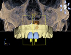 Unedublog3 e4jzps - Eugenol