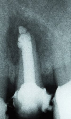 Une 25 sauvée pour combien de temps 1 m3imu6 - Eugenol