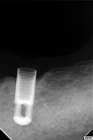 Uqted0kg9mu912lavmfwa9kexoi5 - Eugenol