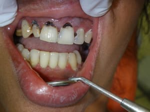 Vaob4prduyv4abalpgrl - Eugenol