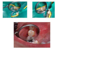 Ver q8x7ud - Eugenol