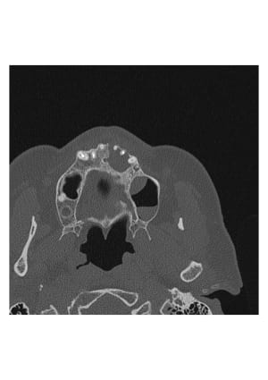 Vue a cjgbhu - Eugenol