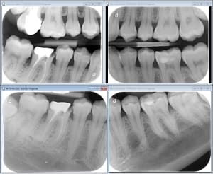 W49xlav4x4k6icnojxnt - Eugenol