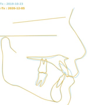 W7itia9g6j6pfs2w10q3rdf0tfny - Eugenol