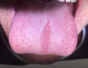 Xdslec1kqnebqdnbtr44 - Eugenol