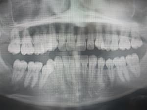 Xrcdaepyxcn8nphfb59l - Eugenol