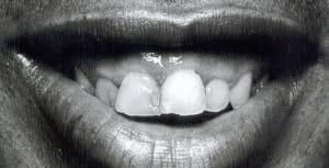 Xxx lgfa4r - Eugenol