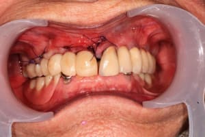 Ylbpmy1jki6xqcsztba5 - Eugenol