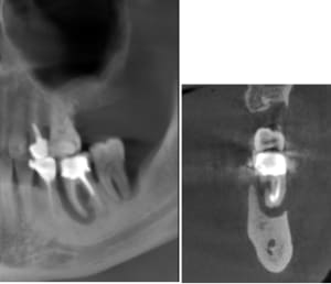 Ytl1j99uarfv30v80yqabwe0yio1 - Eugenol