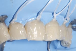 Zki4lcxa2atug16wr2pky1j57rco - Eugenol