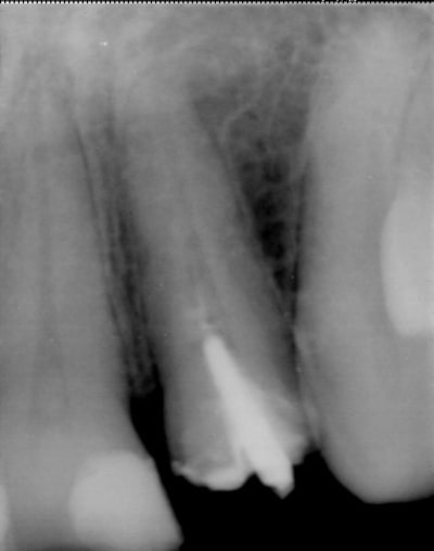 00000005 wozq5f - Eugenol