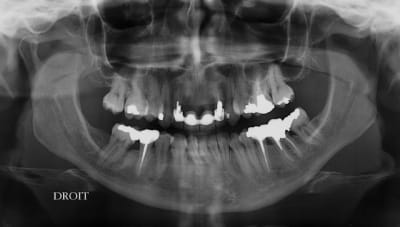 001 fjnsdq - Eugenol