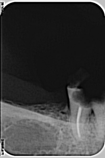 002pr lgbgzf - Eugenol