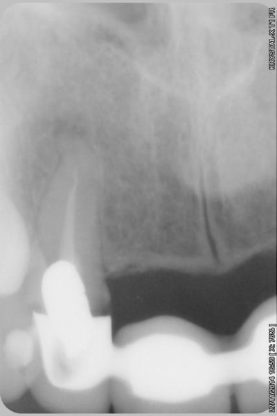 003copier rzc5fr - Eugenol