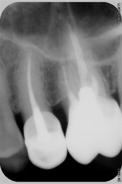 003  4  nfcpyf - Eugenol