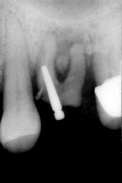 003 auu8yd - Eugenol