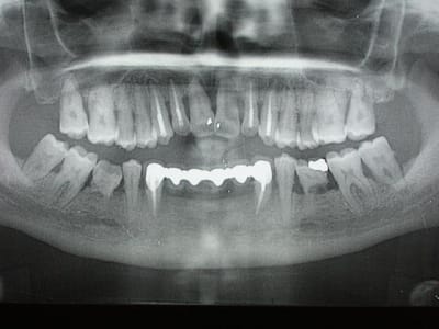 003 o0vbnq - Eugenol