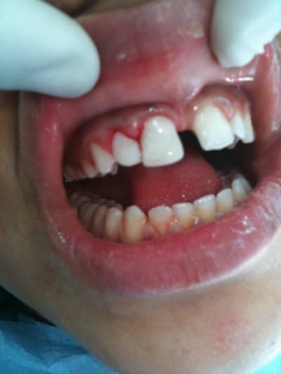 003 rkeuot - Eugenol