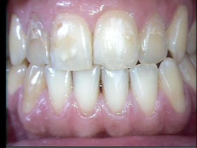 004 yjoift - Eugenol