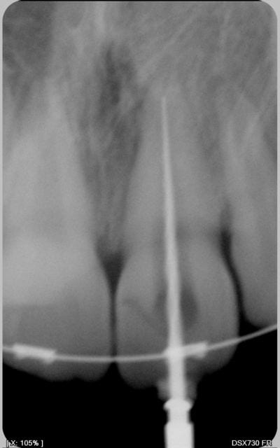 007 rrnore - Eugenol