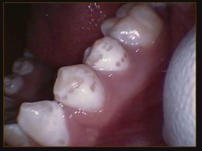 008 u2xofs - Eugenol