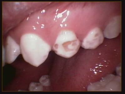 009 uihbec - Eugenol