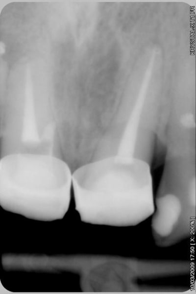 010 vm38xo - Eugenol