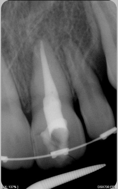 011 kylqth - Eugenol