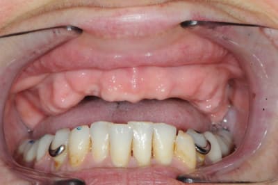 012 trois ans apr s copie r4yqsx - Eugenol