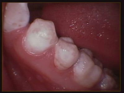 012 vrj61o - Eugenol