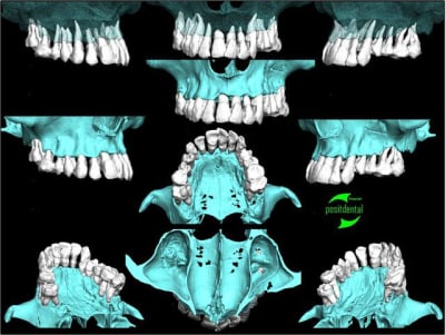 013 guide chirurgical dentaire positdental aswcvc - Eugenol