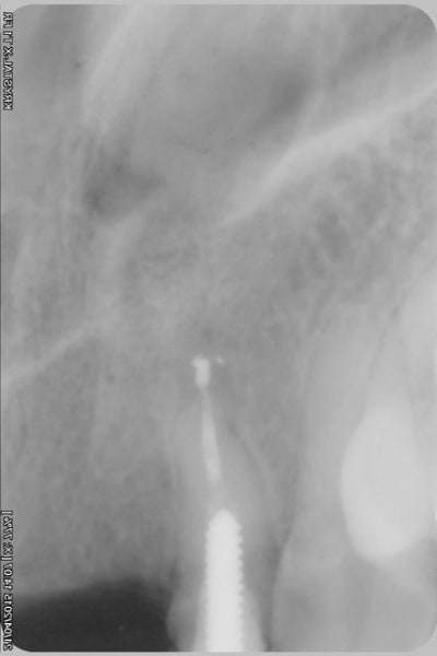 015xcopier lyppuy - Eugenol