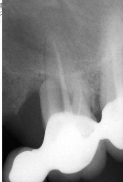 017 uf6ijq - Eugenol